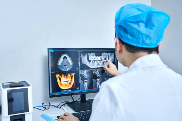 Best Knocked-Out Tooth (Avulsed Tooth) Treatment in Gueydan, LA