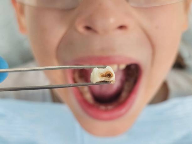 Best Urgent Dental Care for Toothaches in Gueydan, LA